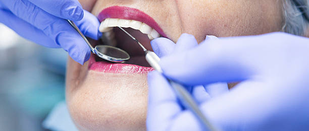 Best Emergency Treatment for Oral Infections in Willits, CA